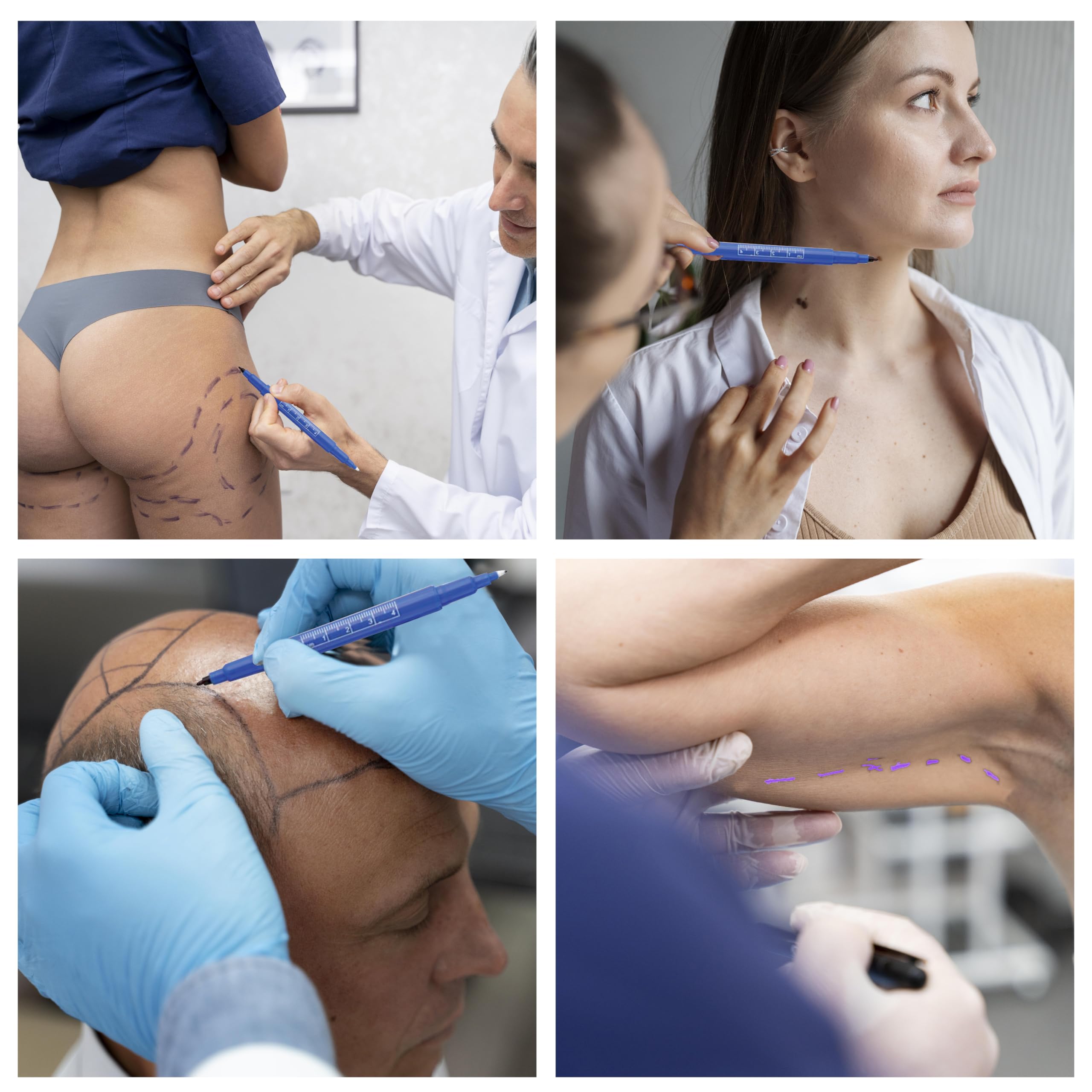 gima-33179-penna-dermatologica-a-doppia-punta-confezione-da-10-per-marcatura-cut image 7